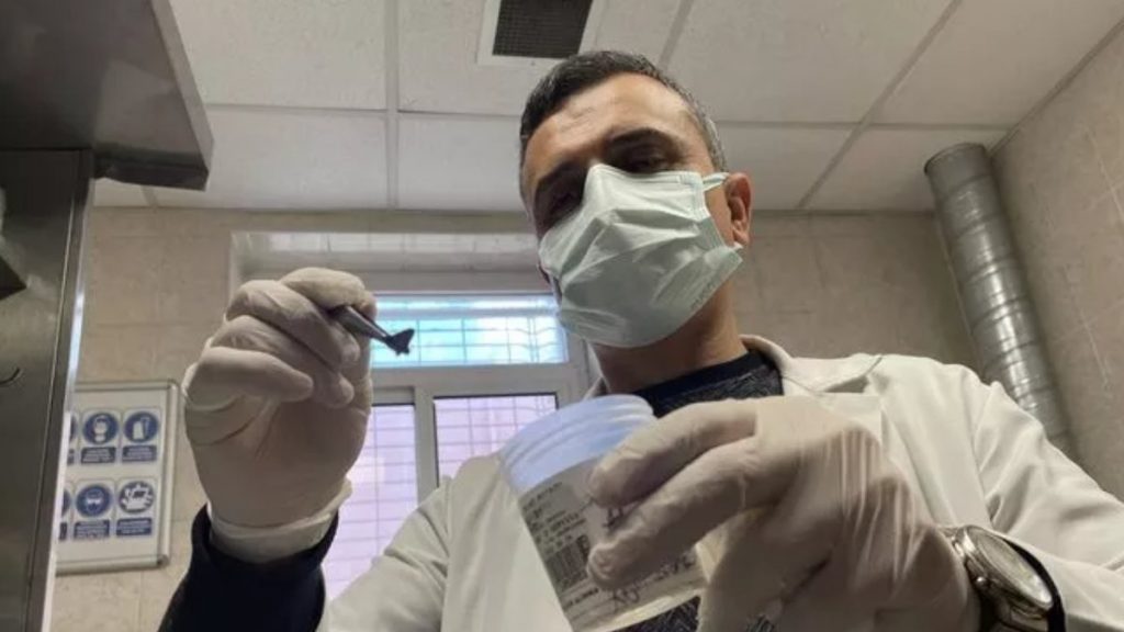 İzmir’de kanser zannedilen hastanın soluk borusundan badem kabuğu çıktı