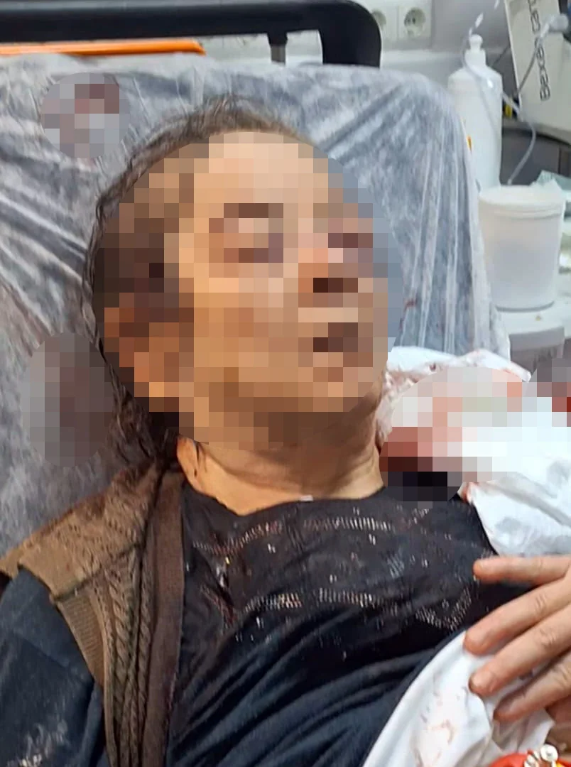Kayseri’de evinde tavandan kopan sıvalar yaraladı