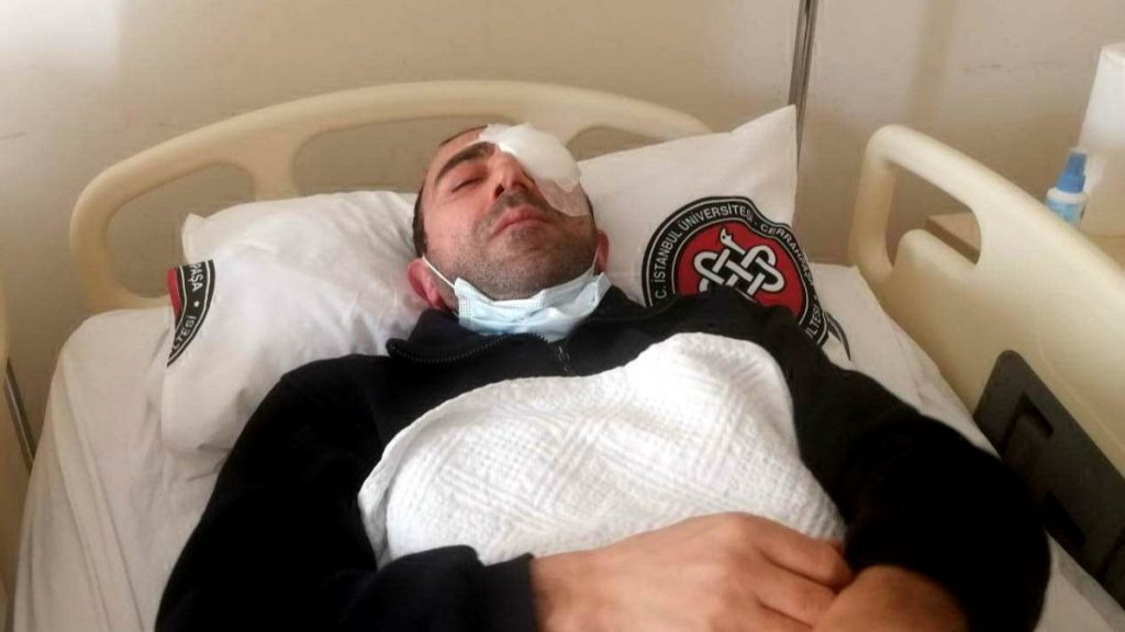 Avcılar’da, kameramanı kör eden dayağa hapis istendi