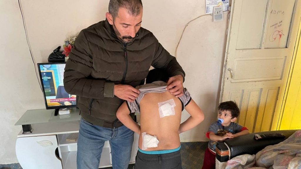 Sivas’ta başıboş köpekler çocuğa saldırdı