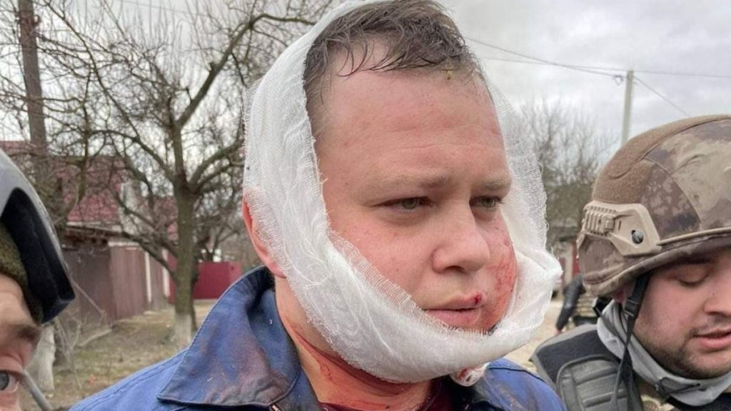 Suriye’de sivilleri bombalayan Rus pilotun Ukrayna’da yakalandığı anlar