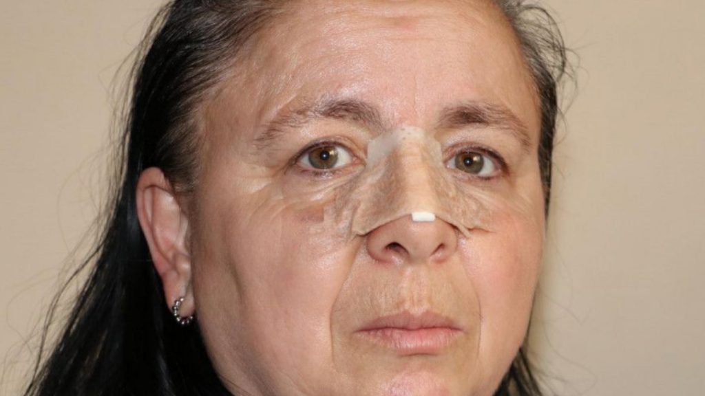 Eskişehir’de birlikte yaşadığı sevgilisi burnunu kırdı